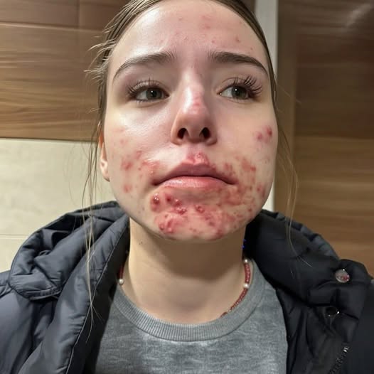 These are the consequences of sleeping with a… See more