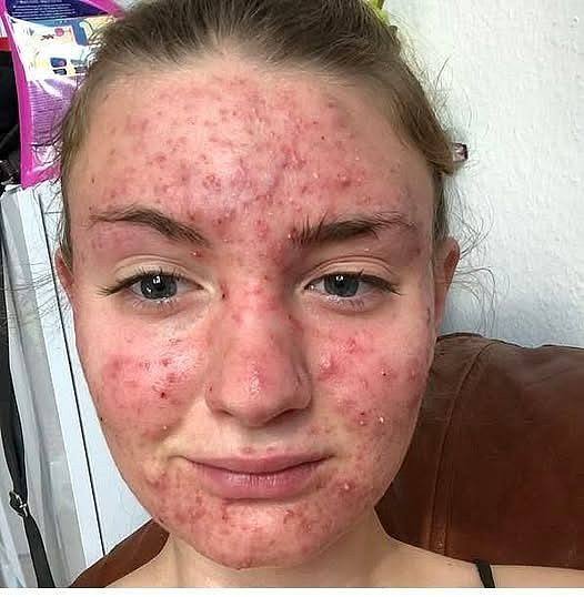 Her body was itching, I thought it was an allergy, they diagnosed ca… see more