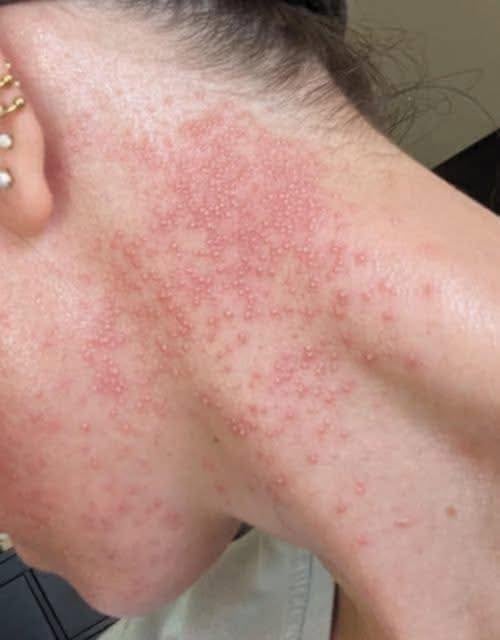 These are the consequences of sleeping with …See more