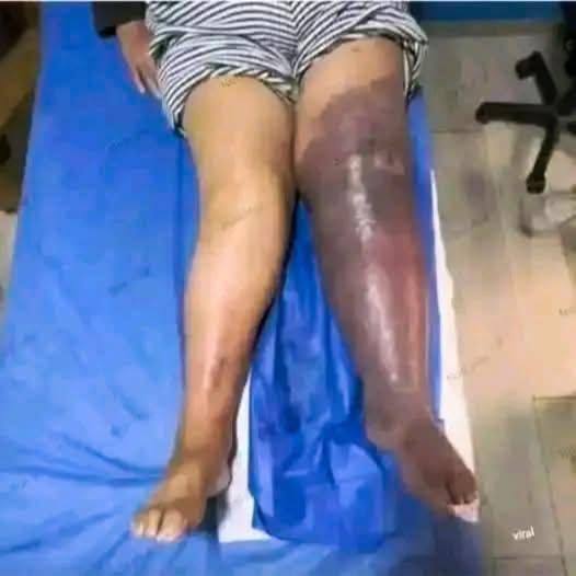 These are the consequences of sleeping with a…See more